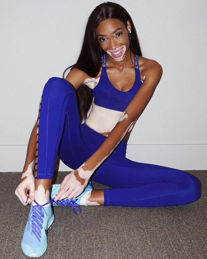 How-To-Make-Extreme-Athleisure-Look-Sexy-According-To-Stars-winnie harlow