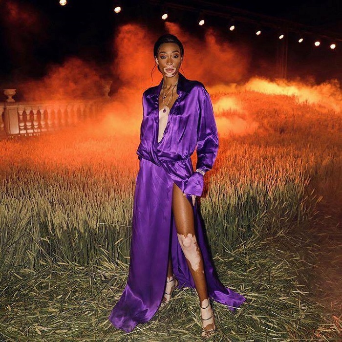 15-Hot-Models-To-Walk-The-Victoria’s-Secret-Runway-For-The-First-Time-winnie harlow