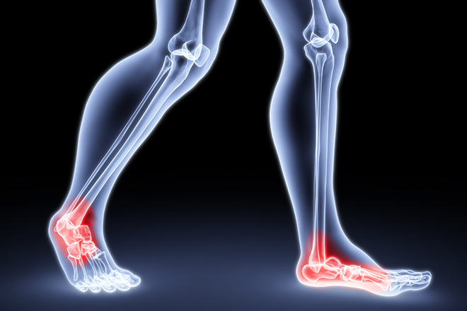 health-uses-for-Hyaluronic-acid-foot-joint-pain