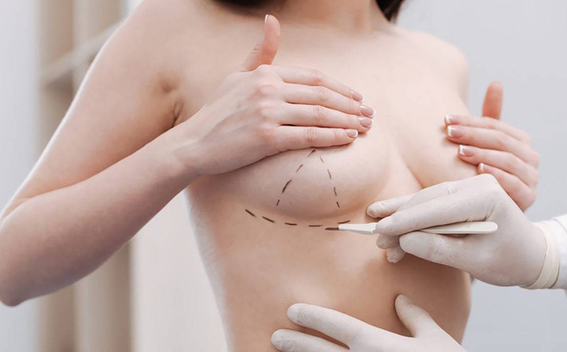 questions-to-think-about-when-considering-plastic-surgery