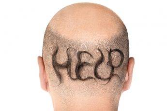 guide-to-combat-mens-hair-loss-main-image-fashionisers-balding-man-with-help-written-on-head-in-hair