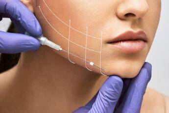 plastic-cosmetic-surgery-face-lift