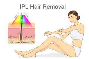 vector-hair-removal