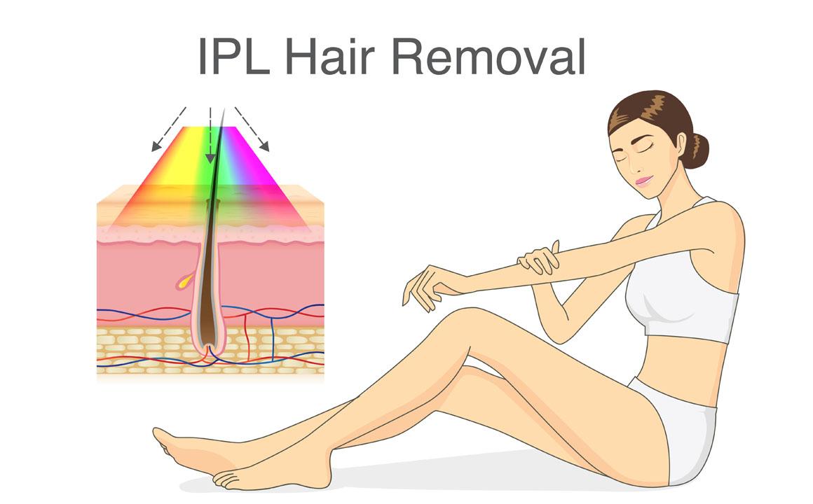 vector-hair-removal