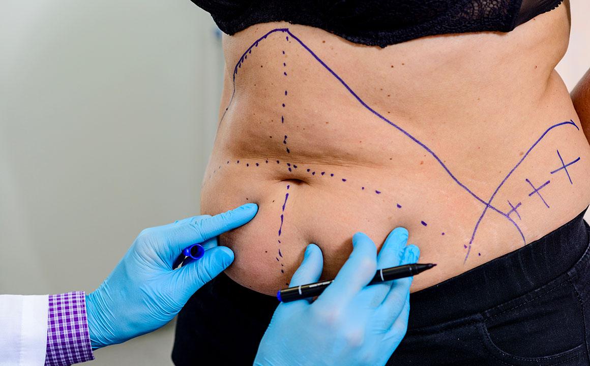 plastic surgery